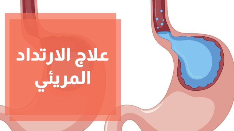 الارتداد المعدي المريئي