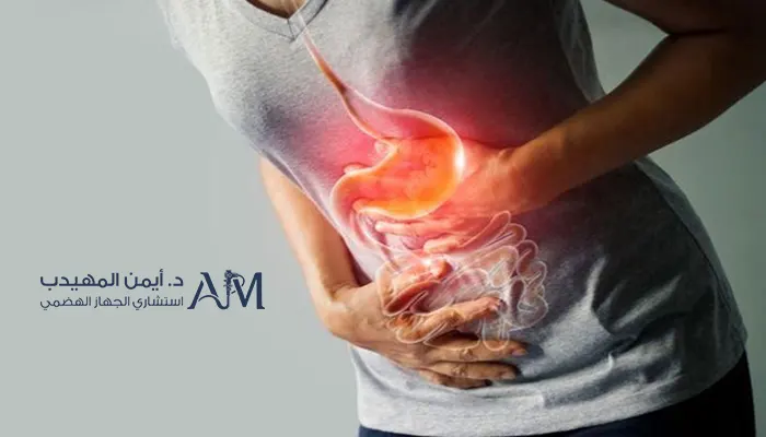 علاج قرحة المعدة بالمنظار