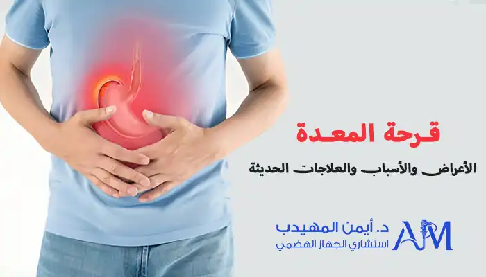 قرحة المعدة الأعراض، الأسباب، والعلاجات الحديثة