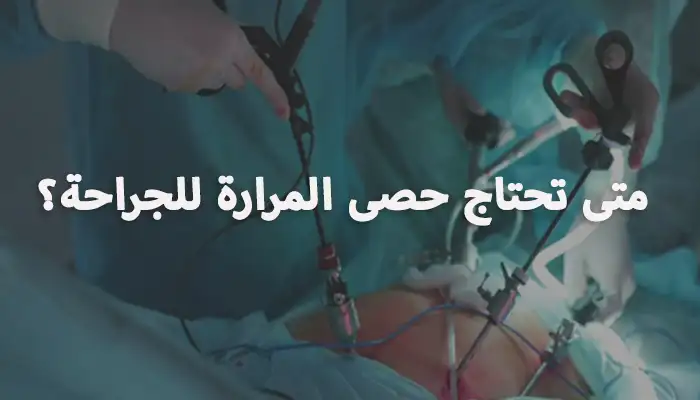 متى تحتاج حصى المرارة للجراحة؟