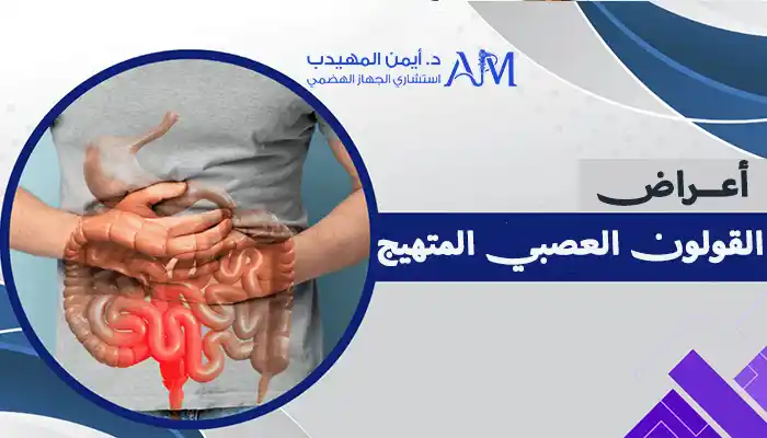 أعراض القولون العصبي المتهيج