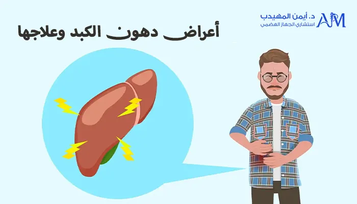 أعراض دهون الكبد وعلاجها