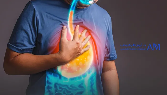 الارتداد المعدي المريئي عند الكبار