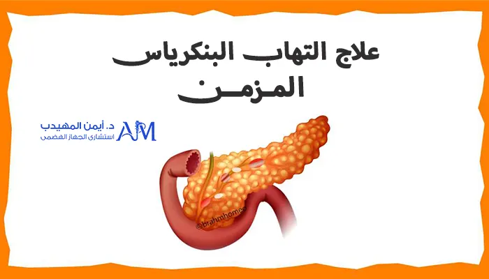 علاج التهاب البنكرياس المزمن