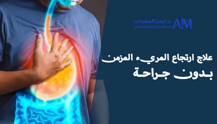 علاج ارتجاع المريء المزمن بدون جراحة