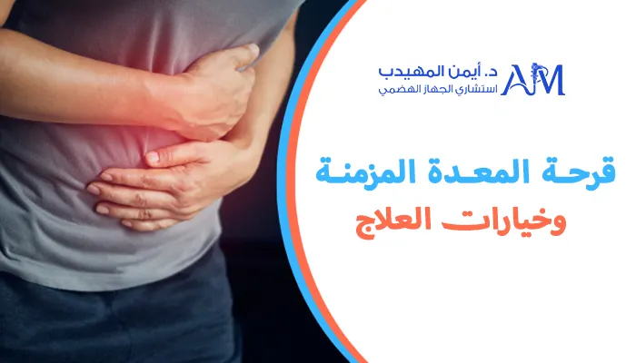 قرحة المعدة المزمنة وخيارات العلاج