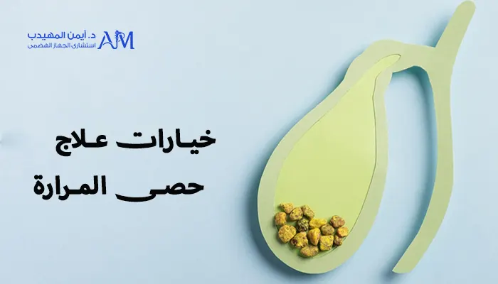 حصى المرارة - 5 خيارات لعلاجها نهائياً