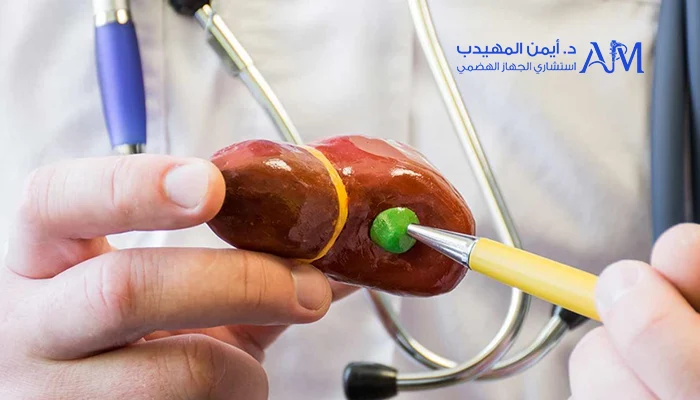 تكلفة عملية المرارة بالمنظار في السعودية