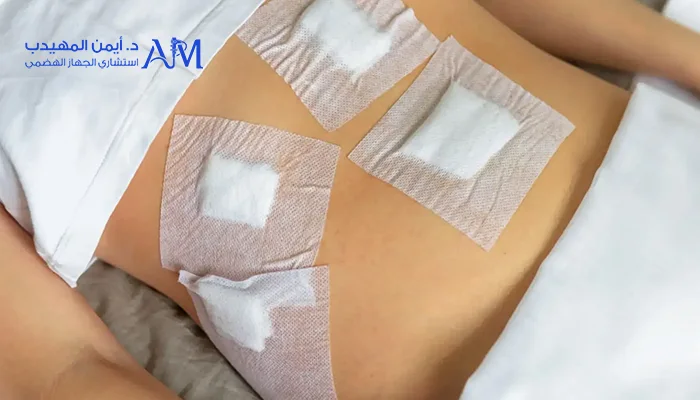 كم مدة الراحة بعد عملية استئصال المرارة بالمنظار؟