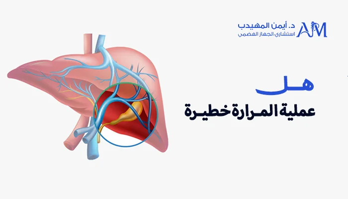 هل عملية المرارة خطيرة
